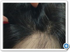 peluca natural alexis 2.8
