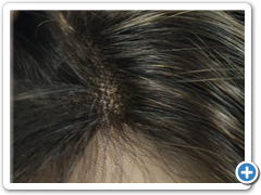 peluca natural alexis 4.9