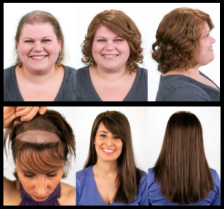 Pelucas oncologicas donostia Clearance