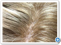 peluca natural alexandra 14 TUL35.40-11