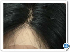peluca natural ANABELEN 1 TUL35.40-7