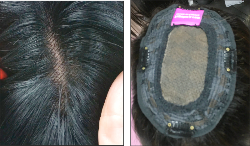 Base de voluminador natural para raya superior con interior visible